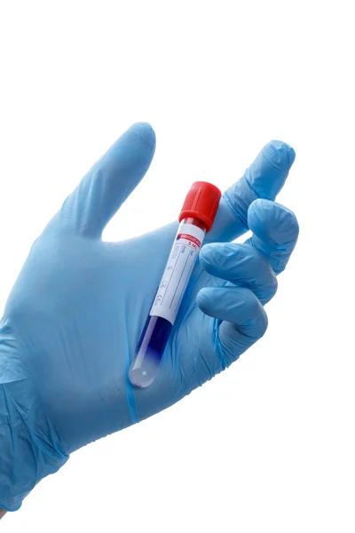 Hand with a test tube — Stock Photo, Image