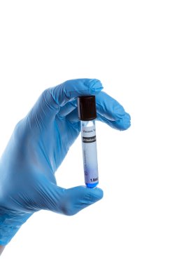 el ile bir test tüpü