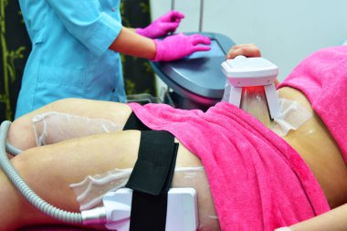 Kriyolipolisis. Donanım kozmetolojisi. Vücut bakımı. Cerrahi olmayan vücut şekillendirme. Vücut geliştirme tedavisi, güzellik salonunda anti-yağ terapisi..