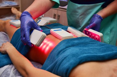 Lipo lazeri. Donanım kozmetolojisi. Vücut bakımı. Cerrahi olmayan vücut şekillendirme. Güzellik salonunda vücut şekillendirme tedavisi, anti-selülit ve anti-yağ terapisi.