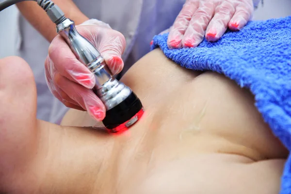 Rf skin tightening, belly. Hardware cosmetology. Body care. Non surgical body sculpting. Ultrasound cavitation body contouring treatment, anti-cellulite and anti-fat therapy in beauty salon.