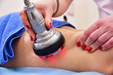 Rf derisi sıkışıyor. Süpürge masajı. Donanım kozmetolojisi. Vücut bakımı. Cerrahi olmayan vücut şekillendirme. Güzellik salonunda anti-selülit ve anti-yağ tedavisi.