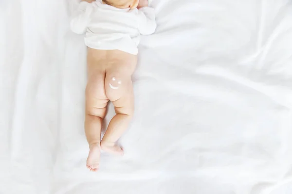 Signo Sonrisa Nalga Del Bebé Con Una Crema Enfoque Selectivo — Foto de Stock