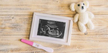 Bebeğin fotoğrafının ve aksesuarlarının ultrason fotoğrafı. Seçici odaklanma. çocuk.