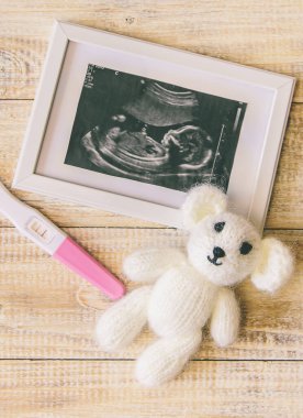 Bebeğin fotoğrafının ve aksesuarlarının ultrason fotoğrafı. Seçici odaklanma. çocuk.