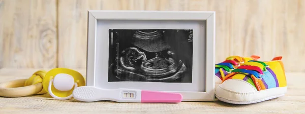 Ultrasound picture of a baby\'s photograph and accessories. Selective focus. child.