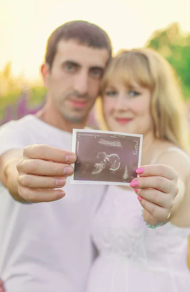 Ultrasonido Instantáneo Mujer Embarazada Hombre Enfoque Selectivo — Foto de Stock