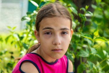 Bir çocukta bahar çiçeği alerjisi. Seçici odaklanma. Doğa.