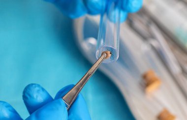 Laboratuvarda analiz için keneler var. Seçici odaklanma. hayvan.