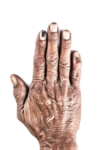 Hombre viejo mano — Foto de Stock