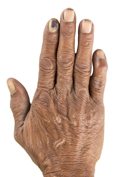 Hombre viejo mano —  Fotos de Stock