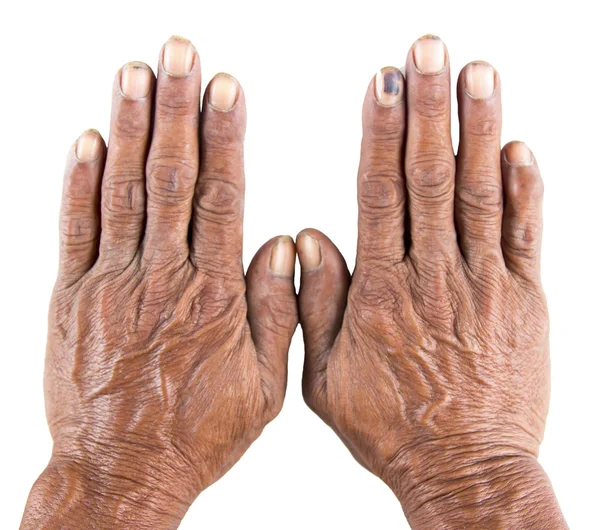 Old man hand — Stock Photo, Image