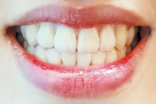 Teeth — Stock Photo, Image