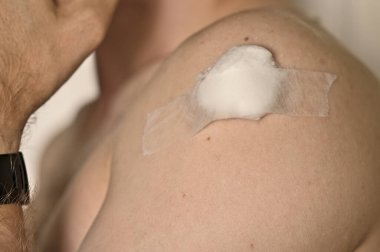 Genç adamın koluna COVID-19 aşısı yapıldığına dair yakın görüntü. İğne izi tıka basa dolgu ve alçıyla kaplı. Dublin, İrlanda