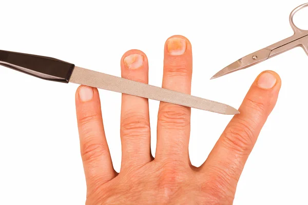 Fingernails with nail fungus — Stock Photo, Image