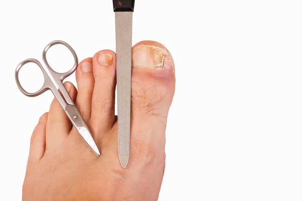 Foot with toenail fungus, scissors and file-isolated — Stock Photo, Image