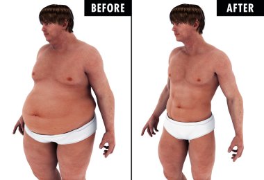Adam ağırlık kaybı vücut dönüşüm öncesi ve sonrası