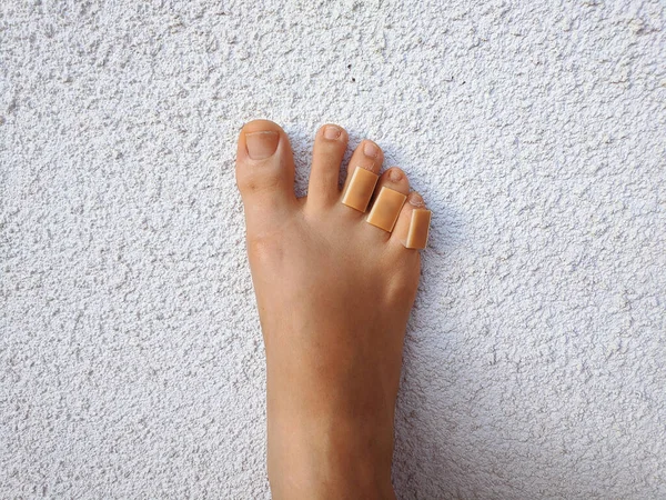 Pernas Mulher Com Emplastro Calo Dedos Dos Pés Cuidado Pele — Fotografia de Stock