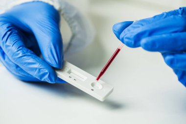 Coronavirus SARS-CoV-2 COVID-19 için antikorları tespit eden hızlı kan testi yapan tıbbi teknisyen RDT kasetine kan örneği yerleştiren bilim adamı veya doktor. 