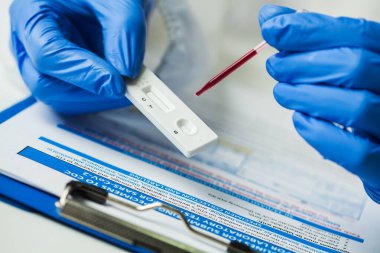 COVID-19 Corona virüsü tarafından belirtilen viral protein antijenleri tespit etmek için hızlı tanı testi RDT 'si uygulayan laboratuvar bilimcisi, CDC hızlı hızlı antikor test noktası