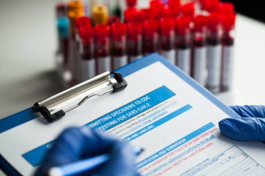 Laboratuvar teknisyeni form dolduruyor, SARS-CoV-2 'nin yeni Corona virüsü hastalığı için laboratuvar testleri yapıyor, arka planda kan örneği olan kalem ve tıbbi dosya tutan ellerin yakın plan görüntüsü.