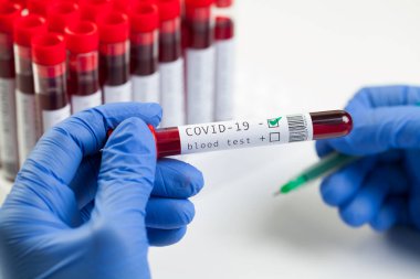 Doktor ya da laboratuar bilimcisi Coronavirus hastasının kan örneğini test tüpüne etiketliyor, Negatif Covid-19 test sonuçları, ölümcül Corona virüsü hastalığı, küresel salgın krizi, WHO hematoloji test prosedürü