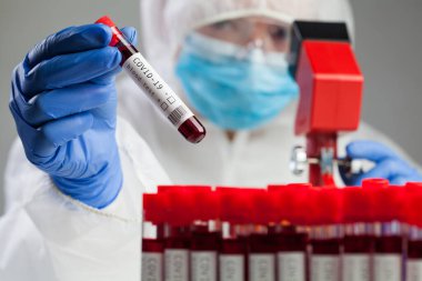 Coronavirus hasta test tüpü kan örneği, ölümcül COVID-19 solunum virüsü hastalığı dünya çapında salgın salgını krizini inceleyen tıp teknisyeni veya laboratuvar bilim adamı mikroskobu.