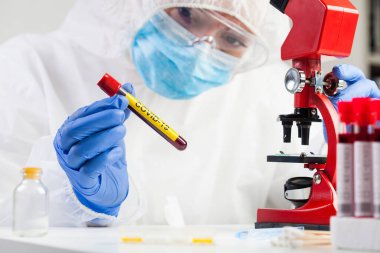 Tıbbi teknisyen elinde COVID-19 test tüpü kan örneği, bulaşıcı Coronavirus hastalığı küresel salgın, tehlikeli hasta numune test analizi prosedürü tutuyor.