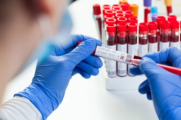 Doctor Lab Scientist Labelling Test Tube Coronavirus Patient Blood Sample — Stock Photo, Image