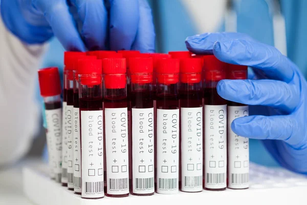 Científico Laboratorio Técnico Médico Que Examina Muestras Sangre Pacientes Con — Foto de Stock