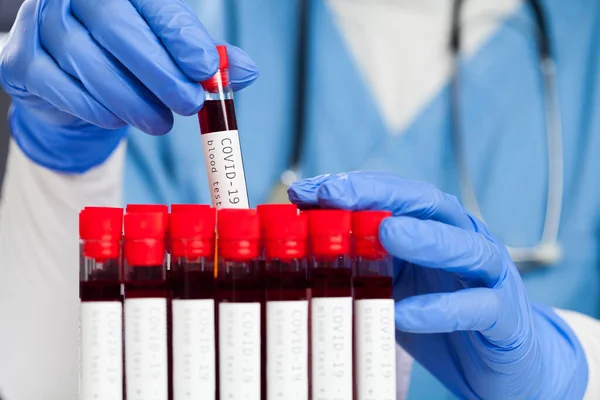 Врач Вытаскивает Красную Пробирку Образцом Крови Пациента Коронавируса Готового Лабораторному — стоковое фото