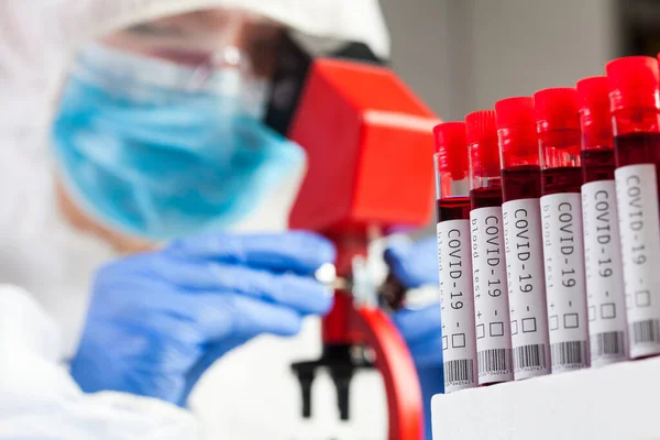 Медичний Технолог Або Лабораторний Вчений Мікроскоп Вивчає Зразки Крові Коронавірусу — стокове фото