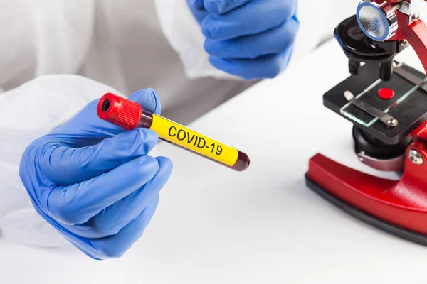 Лаборатория Ученый Медицинский Технолог Держащий Желтый Covid Пробирку Пробы Крови — стоковое фото