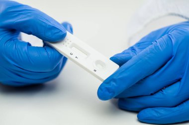 COVID-19 virüs sağlık kontrolü, Coronavirüs küresel salgın salgın krizi, Hızlı Strep Test RST kiti, Hızlı Antijen Tespit RADT, NHS hasta hızlı antikor seroloji analizi