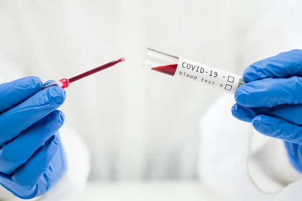 Τεχνικός Εργαστηρίου Ρίψη Δείγματος Αίματος Δοχείο Δοκιμαστικού Σωλήνα Χρήση Πιπέττας — Φωτογραφία Αρχείου