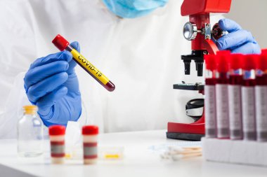 Laboratuvar teknisyeni elinde COVID-19 etiketli test tüpü, kurtarılan Coronavirus hastasının mikroskop analizi kan örneği, antikor nekrozu zengin plazma serumu tedavisi, bağışıklık sistemi