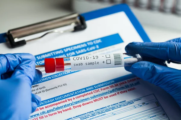 Pcr Covid Virus Sjukdom Diagnostiskt Test Laboratorietekniker Bär Blå Skyddshandskar — Stockfoto