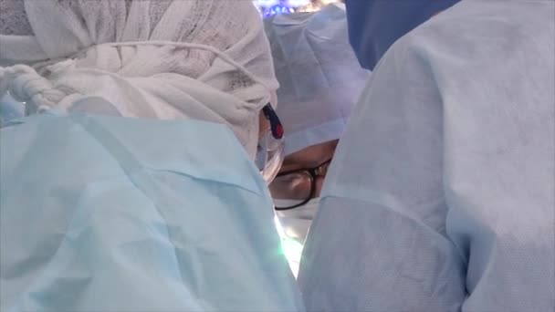 Kyiv, Ukraine, Desember 16, 2017. Team of surgeons in uniform doing surgery operation — Stock Video