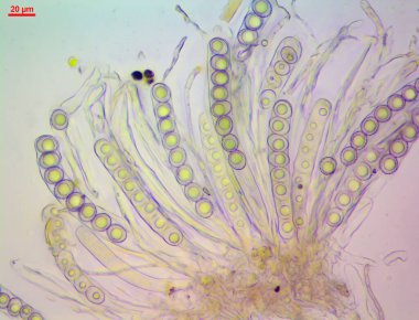 Octospora affinisinin Asci sporları (mantar), istiflenmiş makro fotoğraf