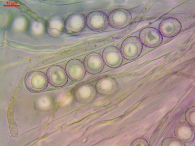 Octospora affinisinin Asci sporları (mantar), istiflenmiş makro fotoğraf