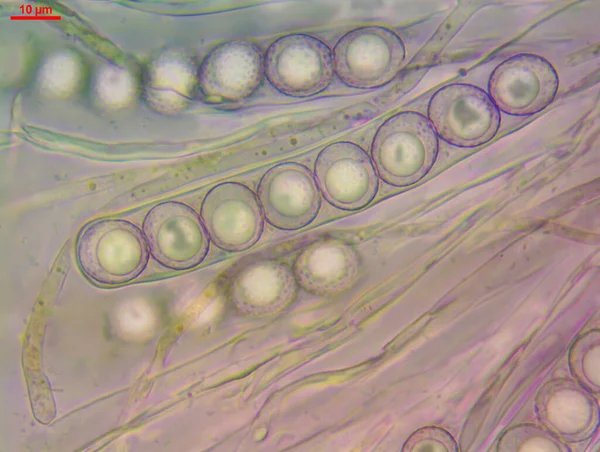 Octospora affinisinin Asci sporları (mantar), istiflenmiş makro fotoğraf