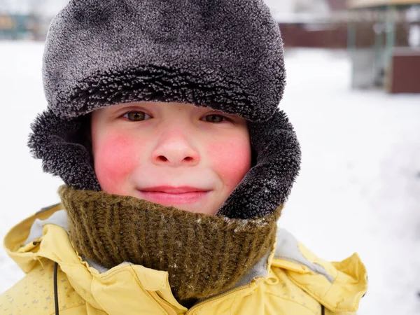 Portrait Toothless Boy Hat Mittens Cold 2021 — Stock Photo, Image