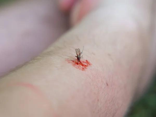 Mosquito Bebe Sangue Mão Close — Fotografia de Stock