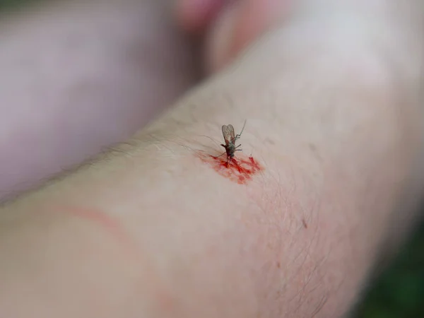 Mosquito Drinks Blood Hand Close — Stock Photo, Image