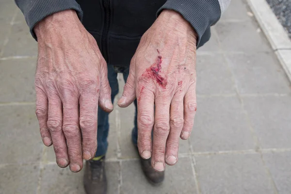 Blodiga och smutsiga händer av en arbetare från baksidan — Stockfoto