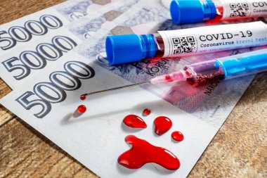 Tehlikeli Coronavirus Covid-19 virüsü laboratuvarda - 2019-nCoV virüsü enfeksiyonu. Koronavirüs salgını nedeniyle küresel salgın riski