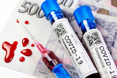 Tehlikeli Coronavirus Covid-19 virüsü laboratuvarda - 2019-nCoV virüsü enfeksiyonu. Koronavirüs salgını nedeniyle küresel salgın riski