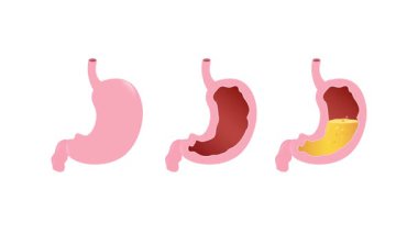 Mideyi dolduran mide asidi, beyaz ve yeşil ekran arka planda