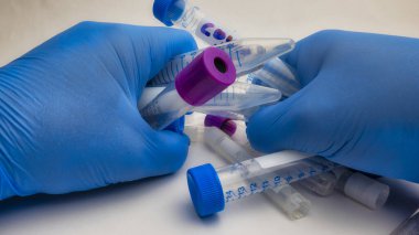 Mavi lateks eldivenli hemşire elleri ve kovid 19 numuneli test tüpü sonucu pozitif çıktı..