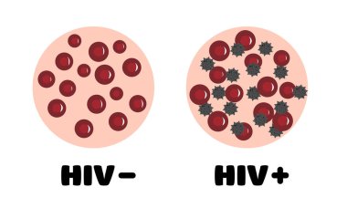 Kanında HIV var. HIV olsun ya da olmasın kan. HIV bulaşmış bir insanın kanı. Kan mikroskop altında. Dünya AIDS Günü. vektör illüstrasyonu